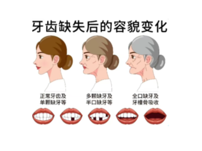 【科學(xué)科普】十個常用的口腔小知識！